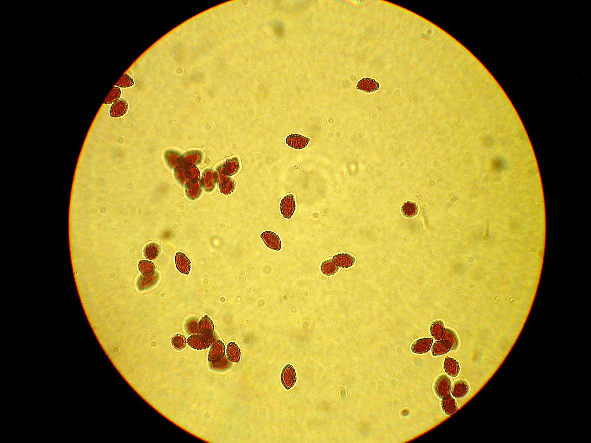 Cortinarius irregularis-spores
